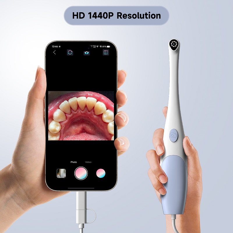 Caméra endoscopique orale 1440 - Photography Lighting Effects avis et prix
