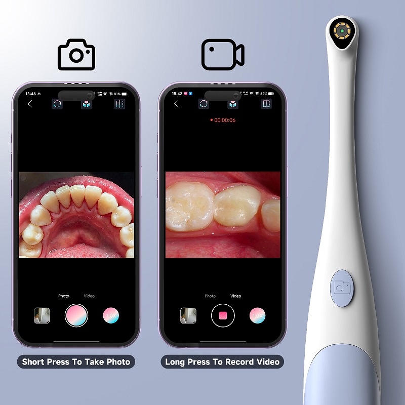 Caméra endoscopique orale 1440 - Photography Lighting Effects avis et prix